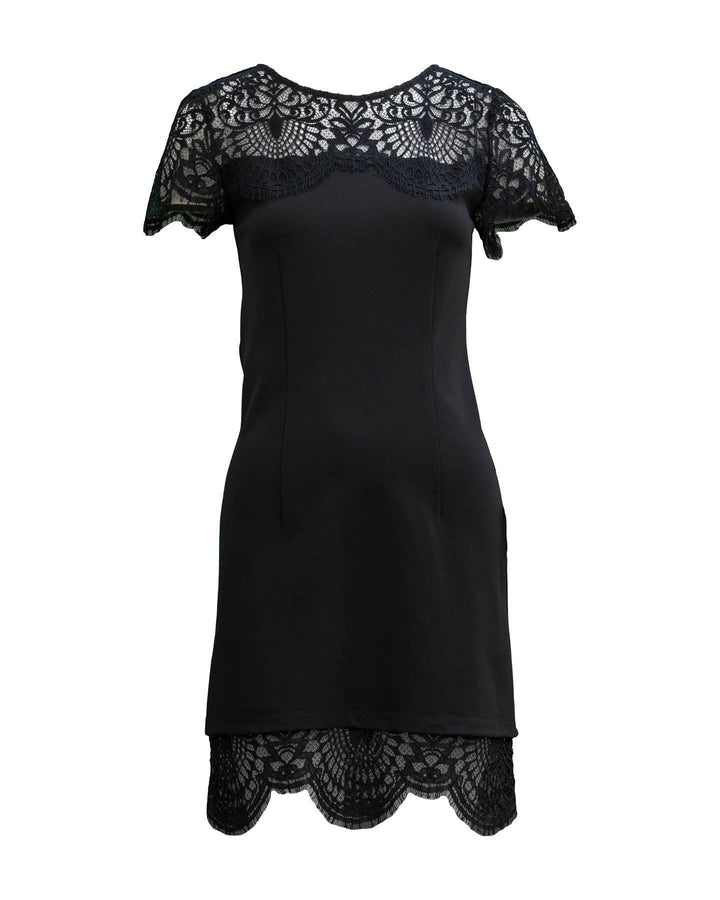 Twinset - Lace Sheath Scalloped Dress